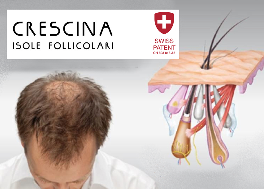 Crescina - Isole Follicolari Crescina - Isole Follicolari